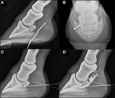 A Rare Case of Deep Digital Flexor Tendinopathy following Centesis of the Navicular Bursa